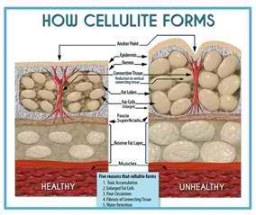 How to Do Away with Cellulite Using Dermarolling Treatment? - Derma Roller  Shop