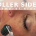 Worried about derma roller side effects? Find out what to expect after derma rolling and if there are any derma roller side effects you should know.